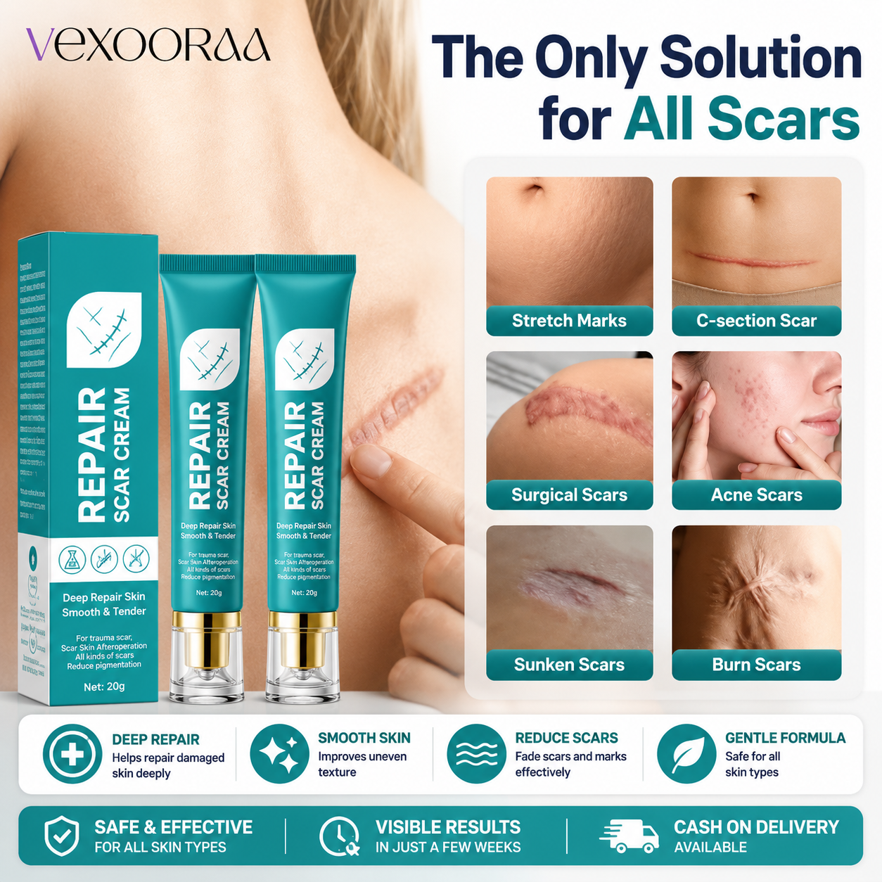 50% OFF + BUY 1 GET 1 FREE ✨ LIMITED OFFER 🔥 Advanced Scar Repair Cream💎